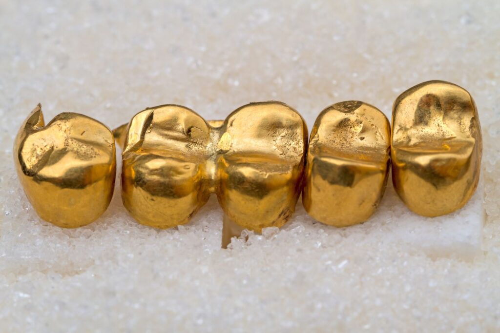 Gold Crowns - Dentech