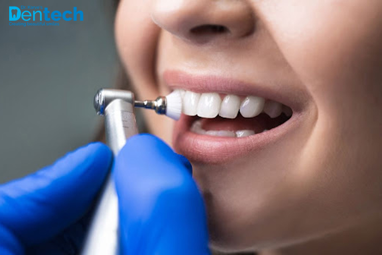 Confused Between Teeth Cleaning and Teeth Whitening - Dr. Karve's Dentech