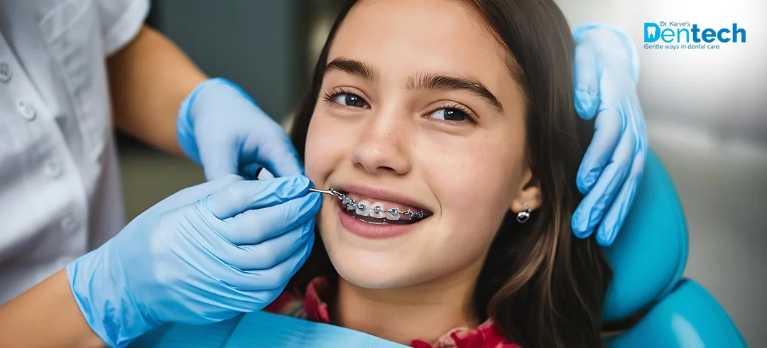 Orthodontics Treatment in Powai at Dr. Karve's Dentech