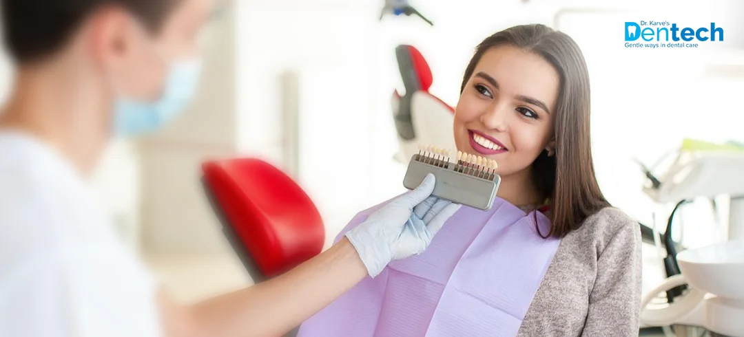 Dental Veneers Treatment in Powai at Dr. Karve's Dentech